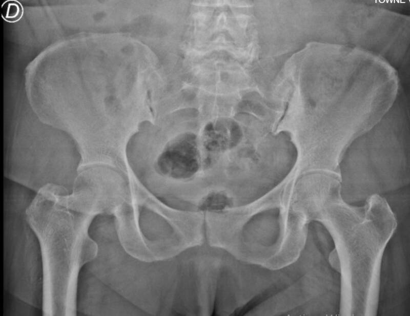 Estudios de Imagen - Pelvis
