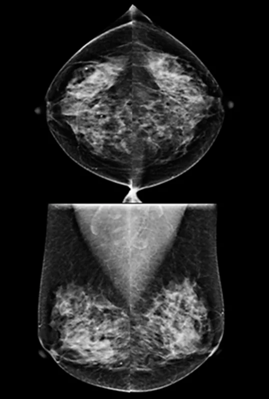 estudios de imagen,estudio de imagen